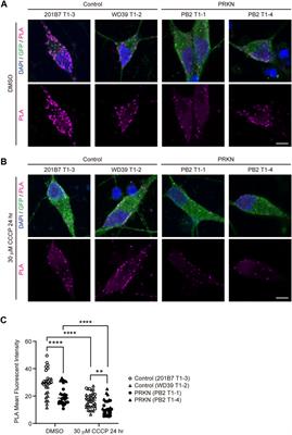 Reduced ER-mitochondrial contact sites and mitochondrial Ca2+ flux in PRKN-mutant patient tyrosine hydroxylase reporter iPSC lines